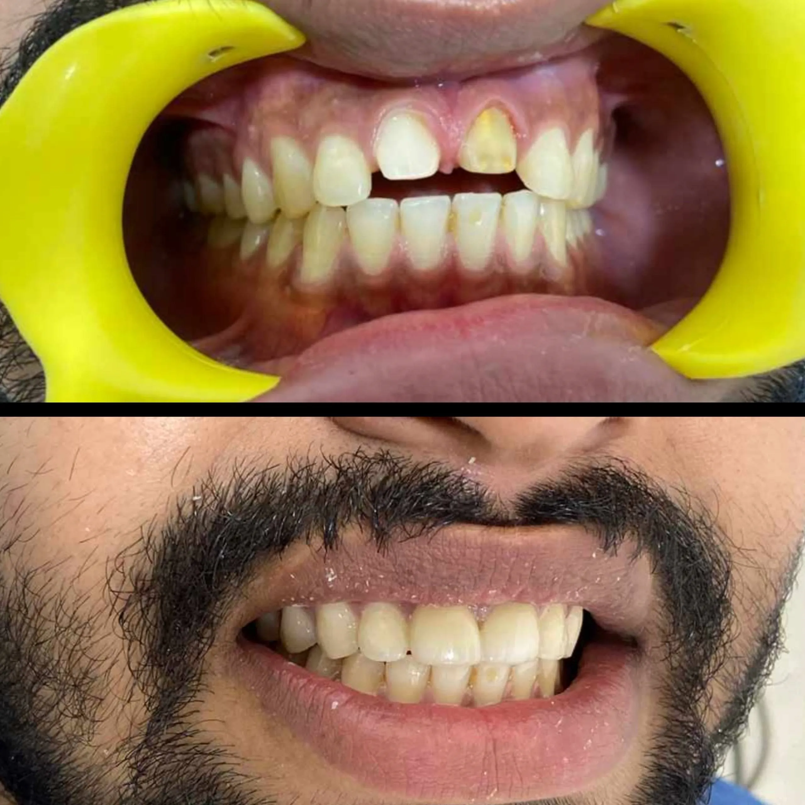 Patient treatment result — before and after